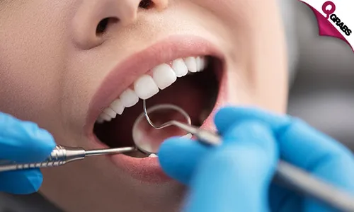 Teeth Whitening + Scaling + Polishing + Consultation!